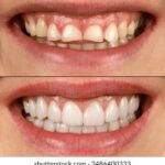 2025235期开奖结果最新公布,速来查看中奖详情 akqwxbnd